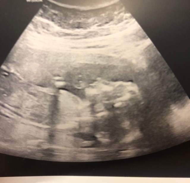 36C41B55-F35C-4346-A171-6E7C9FEFCDDD